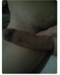 Sex snel contact